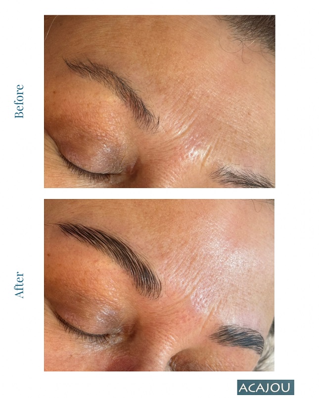 Eyebrows Before & After